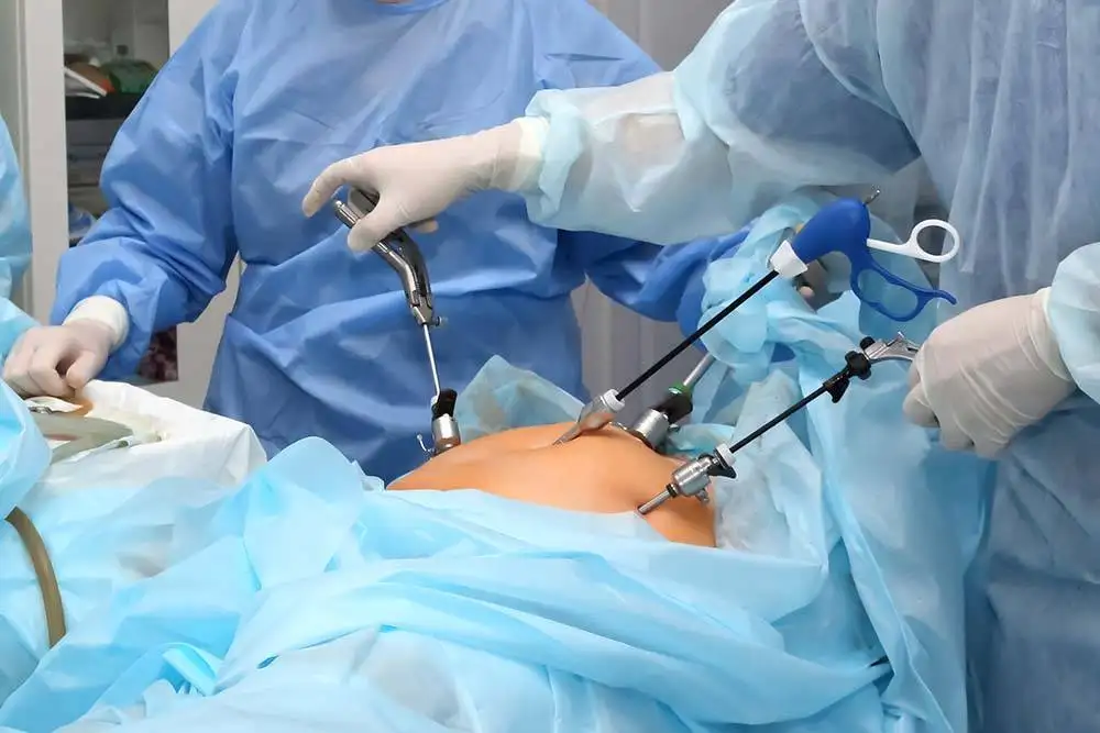 All Laparoscopic Surgeries